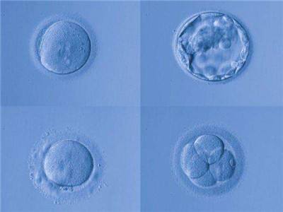 囊胚,囊胚移植,试管婴儿,三代试管
