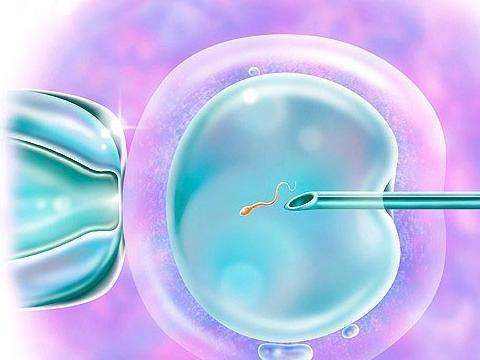 试管婴儿,精子获能,卵子,受精