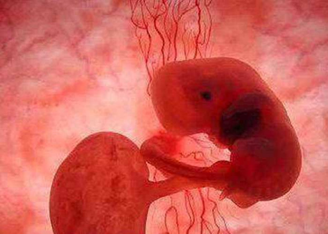 胎停育,三代试管婴儿,胚胎