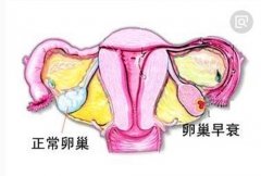 28岁的年纪50岁的卵巢！杭州姑娘停经半年，一查