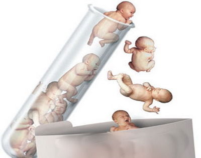 试管婴儿,不孕不育,胚胎移植,取卵