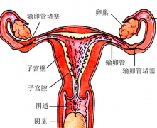 子宫纵隔对怀孕有什么影响？能做试管吗？