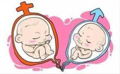 做试管婴儿一定可以怀上双胞胎吗