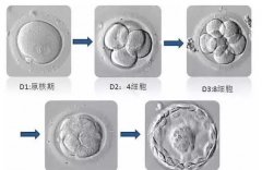 试管婴儿胚胎等级4AA是什么意思