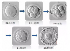 试管婴儿移植鲜胚和囊胚有什么区别