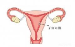 女性子宫内膜薄的原因有哪些