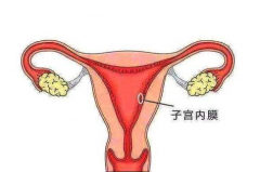 导致子宫内膜增厚 引起不孕的三大原因