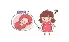 发生胎停育的原因有哪些