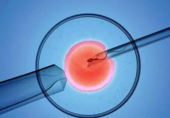 试管婴儿促排卵会导致女性卵巢早衰吗