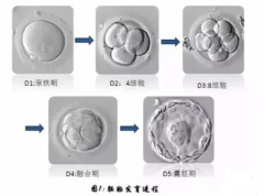 俄罗斯试管婴儿为什么只选择移植单囊胚