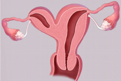 残角子宫手术修复后能正常怀孕吗