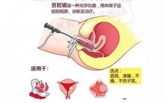 试管婴儿前做宫腔镜会对子宫造成伤害影响吗