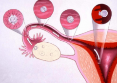 输卵管堵塞导致不孕 有什么方法可以疏通输卵管