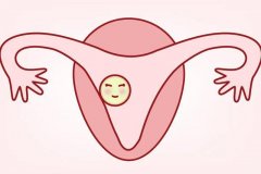 子宫内膜异位做深圳试管婴儿成功率大吗？