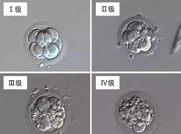 试管婴儿技术，乌克兰试管婴儿