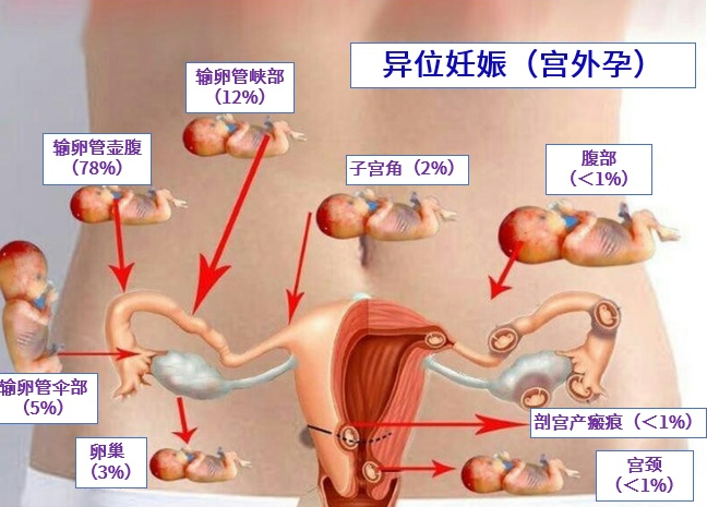 试管婴儿技术，俄罗斯试管婴儿